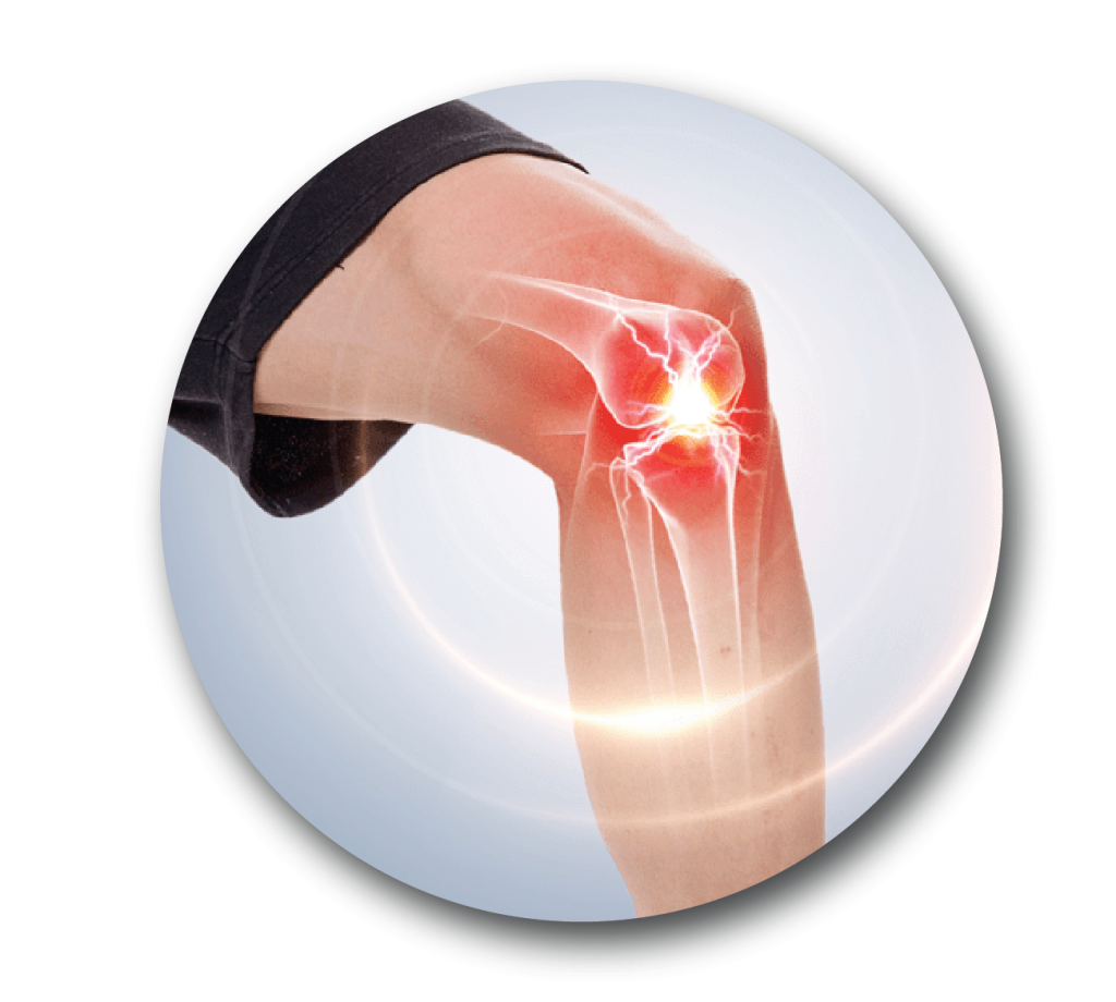 膝盖不同部位疼是什么病？疼痛科专家一表教你辨别 - 知乎